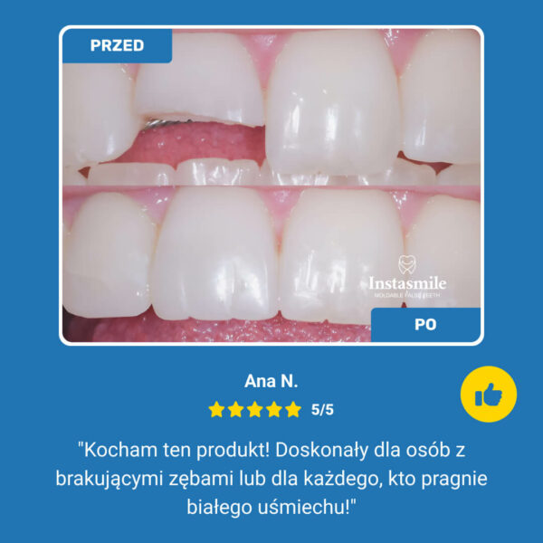 ZESTAW DO LECZENIA ZĘBÓW INSTASMILE